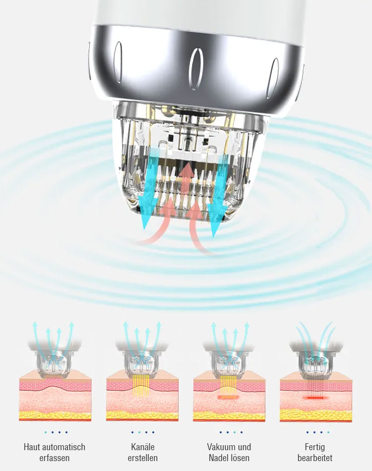 Microneedling Radiofrequenz by Visage Cosmetic