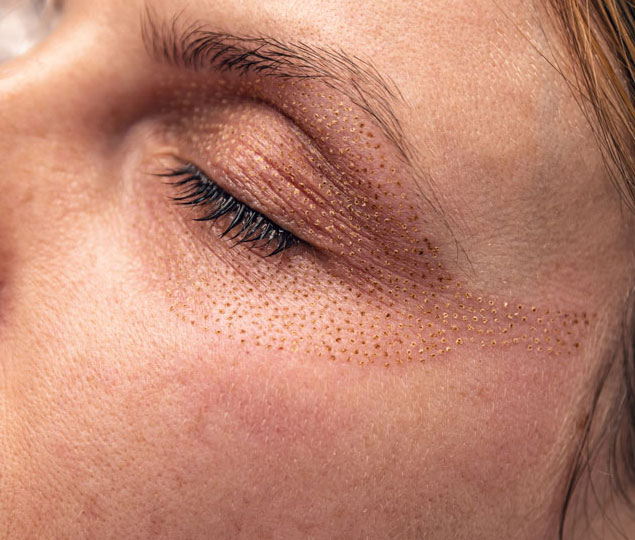 Visage Plasma Skin Schulung