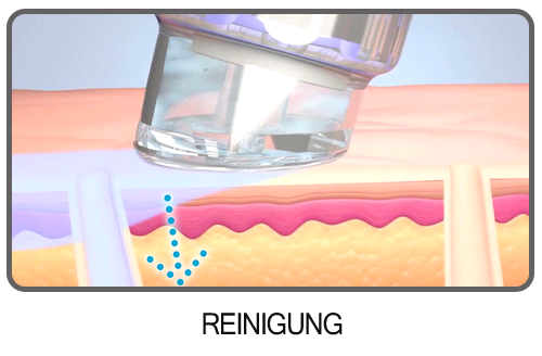 Reinigung