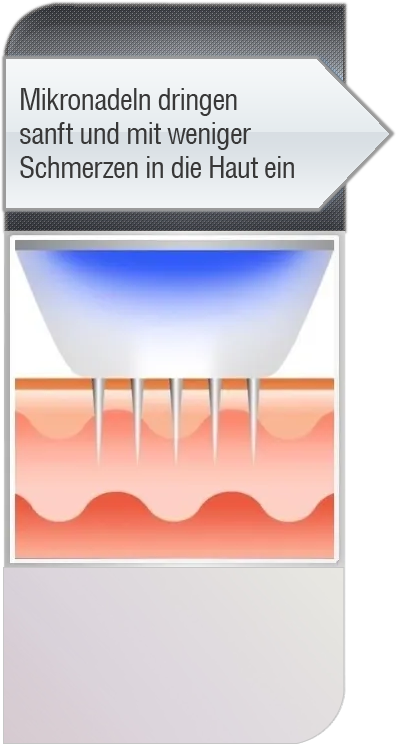 Mikronadel dringen ein Innenseite der Haut