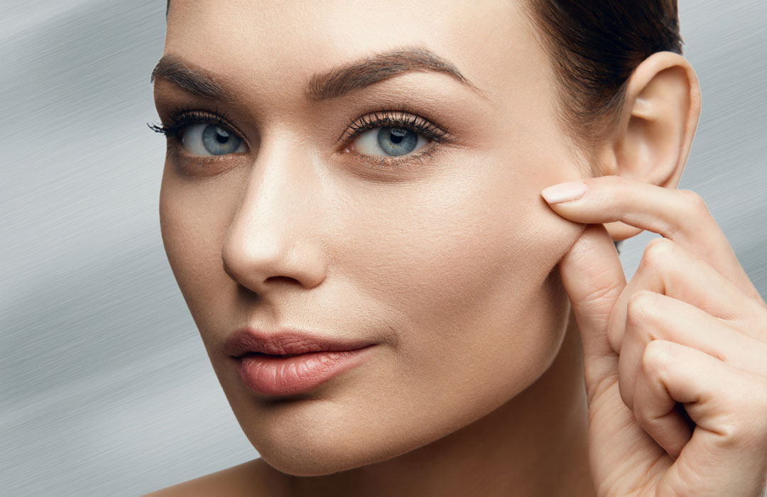 Microneedling